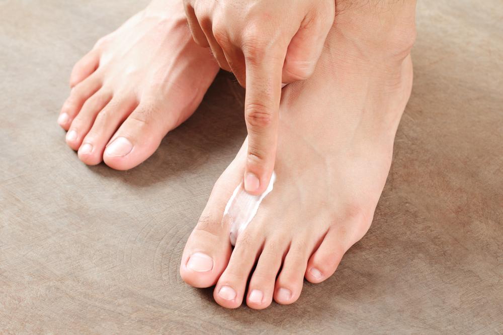 Salbe gegen Fußpilz